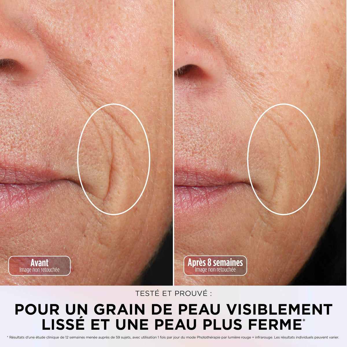 Masque LED Shark CryoGlow avec rafraîchissement du contour des yeux - Sauge
